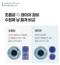 BGN 밝은눈안과 백내장 수정체낭 절개 방식 비교 브랜드 콘텐츠