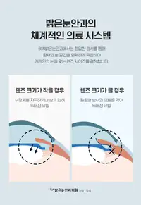 BGN 밝은눈안과 안내렌즈 사이즈 정밀 측정 안내 브랜드 콘텐츠