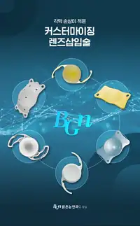 BGN 밝은눈안과 커스터마이징 렌즈삽입술 브랜드 콘텐츠
