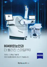 BGN 밝은눈안과 스마일PRO 레이저 장비 소개 브랜드 콘텐츠