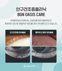 BGN 밝은눈안과 안구건조증 클리닉 마이봄샘 검사 카드뉴스