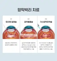 BGN 밝은눈안과 망막박리 치료 방법 안과 정보 카드뉴스