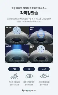 BGN 밝은눈안과 각막강화술 안내 카드뉴스