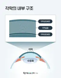 BGN 밝은눈안과 각막 내부 구조 안과 정보 카드뉴스