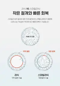 BGN 밝은눈안과 라식과 스마일라식 절개 방식 비교 카드뉴스