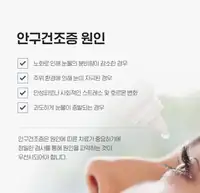BGN 밝은눈안과 안구건조증 원인 안과 정보 카드뉴스