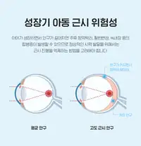 BGN 밝은눈안과 성장기 아동 근시 진행 위험 안내 카드뉴스