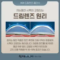 BGN 밝은눈안과 드림렌즈 각막 교정 원리 카드뉴스