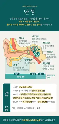 청이담한의원 난청의 정의와 주요 증상 안내 브랜드 카피