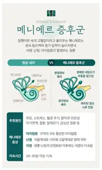 청이담한의원 메니에르 증후군 정리 블로그 콘텐츠
