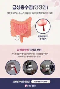 은평연세병원 급성충수염(맹장염) 인포그래픽