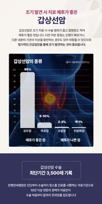 은평연세병원 갑상선암 인포그래픽