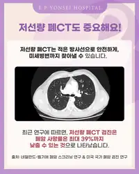 은평연세병원 SNS 콘텐츠 — 저선량 폐CT