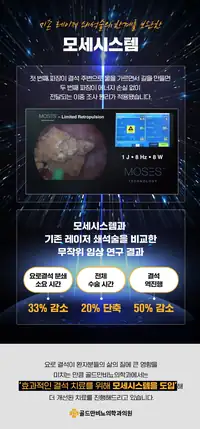 골드만비뇨의학과 요로결석 레이저 쇄석 시스템 소개 브랜드 콘텐츠