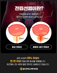 골드만비뇨의학과 전립선염 질환 설명 수술 브랜딩 콘텐츠