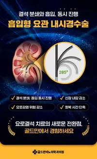 골드만비뇨의학과 흡입형 요관 내시경수술 안내 수술 브랜딩 콘텐츠