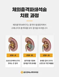 골드만비뇨의학과 체외충격파쇄석술 치료 과정 안내 비뇨기질환 콘텐츠