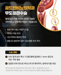 골드만비뇨의학과 무도정관수술 안내 비뇨기질환 콘텐츠