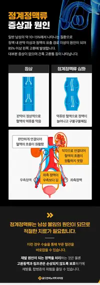 골드만비뇨의학과 정계정맥류 증상과 원인 안내 비뇨기질환 콘텐츠