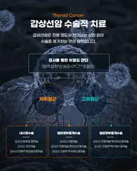 민병원 갑상선암 수술적 치료와 위험도 판단 안내 콘텐츠