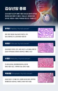 민병원 갑상선암 종류 안내 정보 콘텐츠