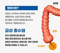 민병원 급성 충수염 안내 정보 콘텐츠
