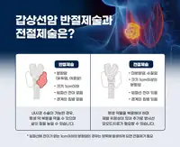 민병원 갑상선암 반절제술과 전절제술 비교 안내 콘텐츠
