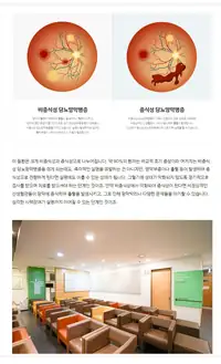 새빛안과병원 비증식성·증식성 당뇨망막병증 비교 브랜드 콘텐츠