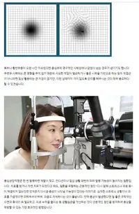 새빛안과병원 황반부종 자가 점검과 망막 검사 브랜드 콘텐츠