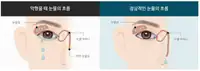 새빛안과병원 눈물길 폐쇄와 정상 눈물 흐름 비교 일러스트
