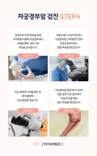서울IVF여성의원 자궁경부암 검진 단계 안내 콘텐츠