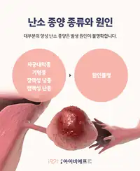 서울IVF여성의원 난소 종양 종류와 원인 안내 콘텐츠