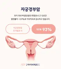 서울IVF여성의원 자궁경부암 조기 발견 안내 콘텐츠